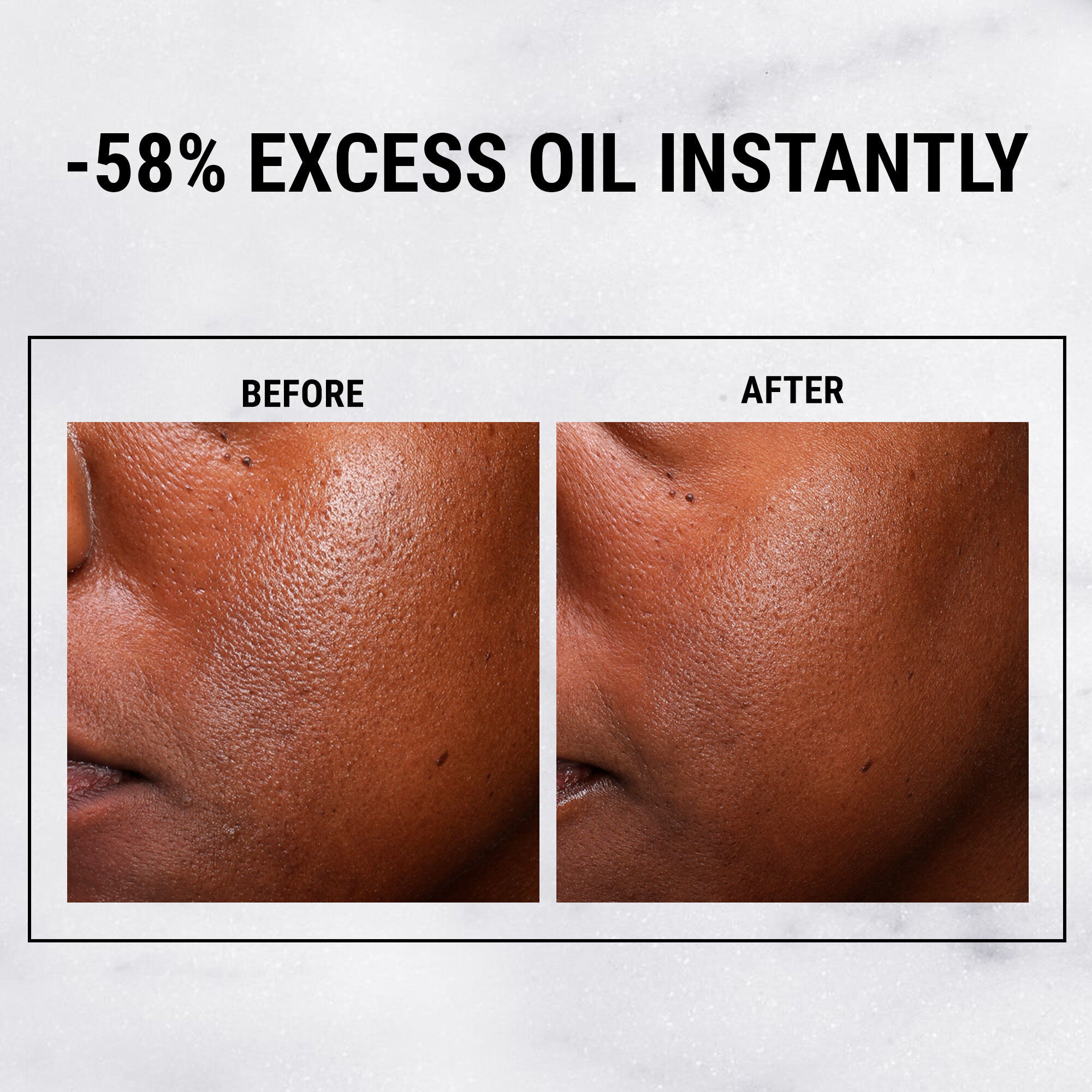 Dưỡng Chất Dưỡng Da Ultra Pure Serum 5% Niacinamide