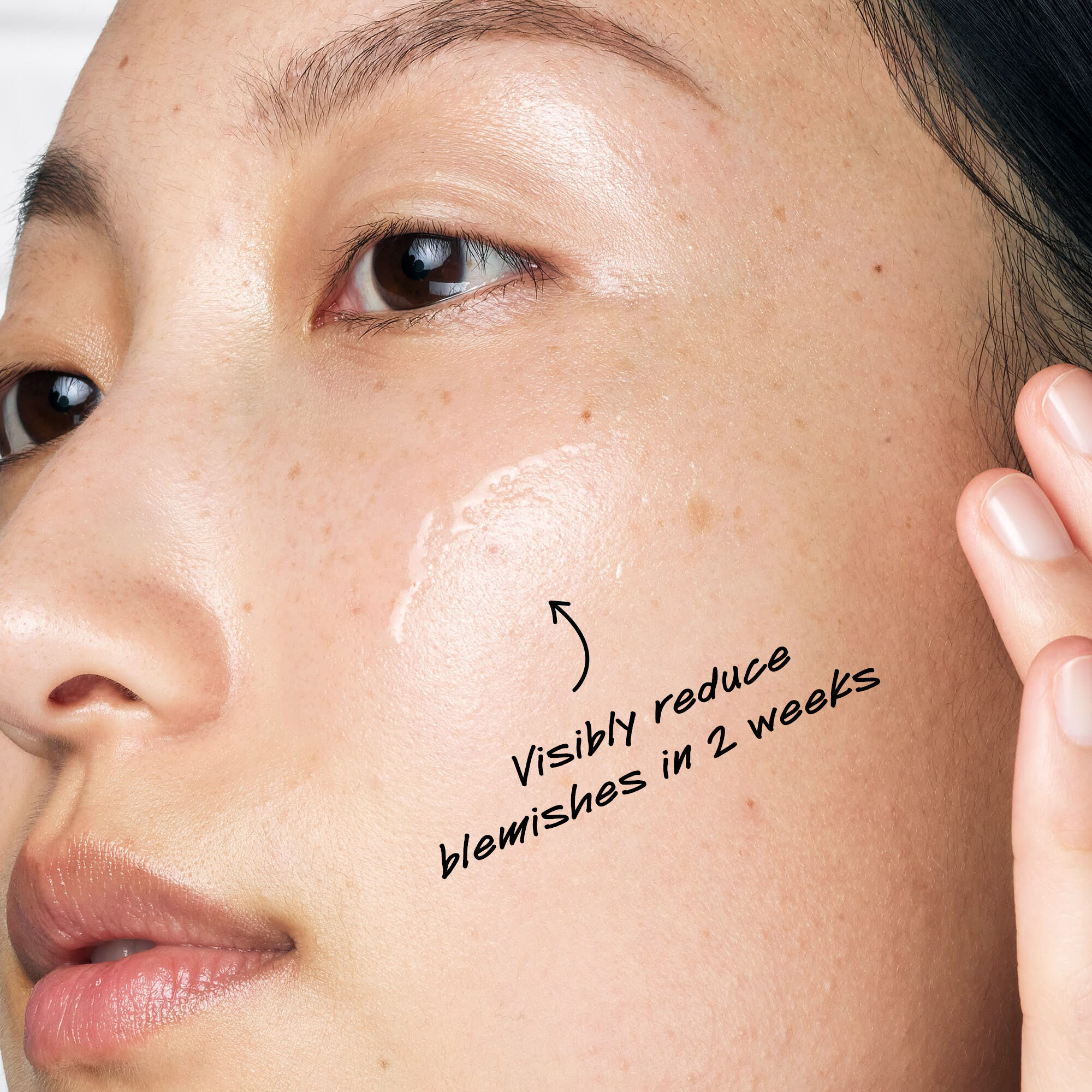 Dưỡng Chất Dưỡng Da Ultra Pure Serum 5% Niacinamide