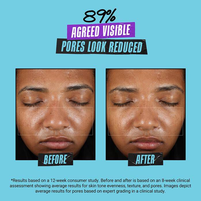 Kem Dưỡng Super Multi-Corrective Soft Cream