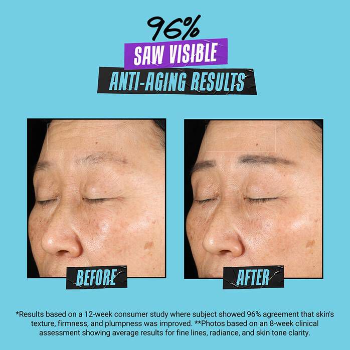 Kem Dưỡng Super Multi-Corrective Soft Cream