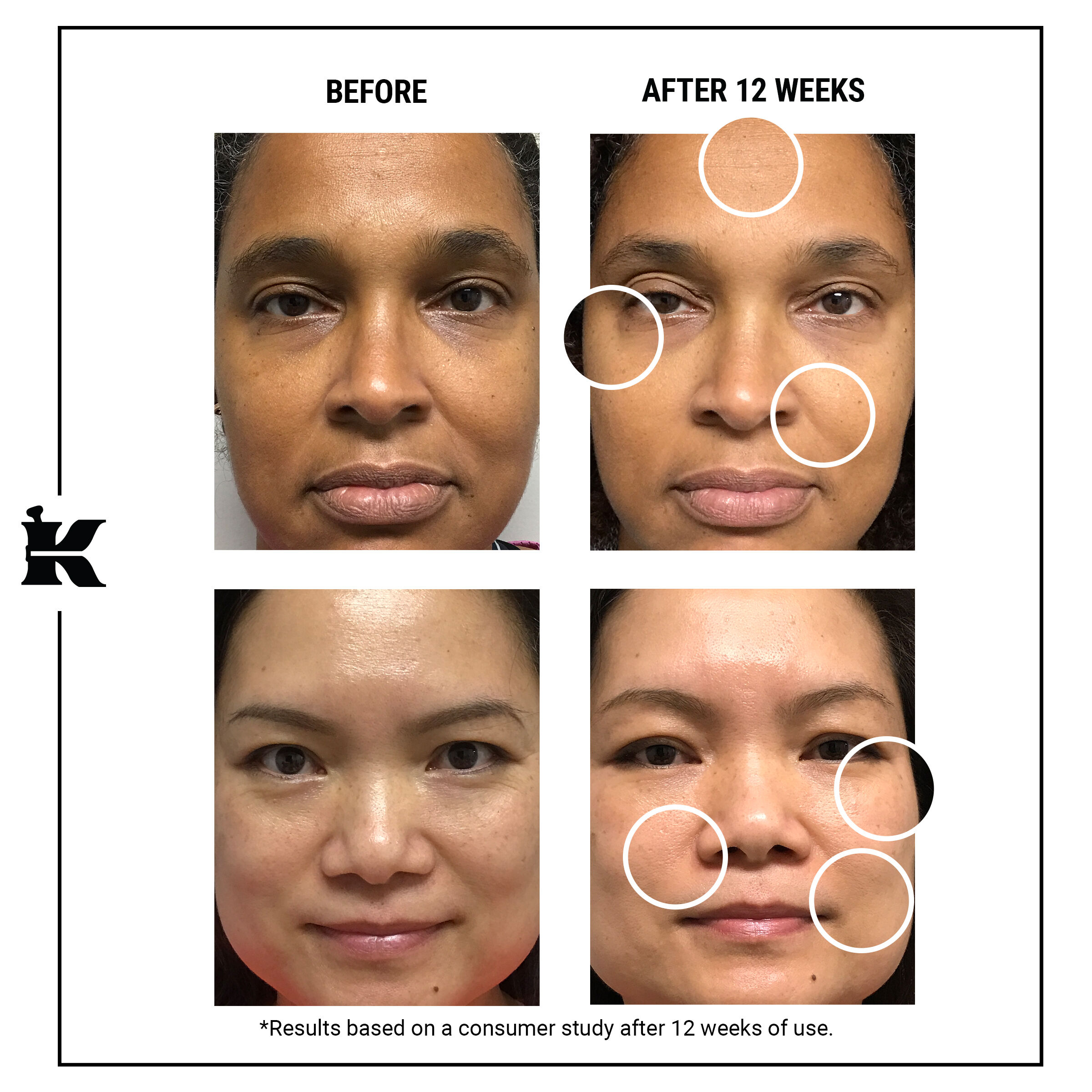 Serum Kiehl's Retinol Giá Khuyến Mãi Lên Đến 50 Kèm Quà Tặng