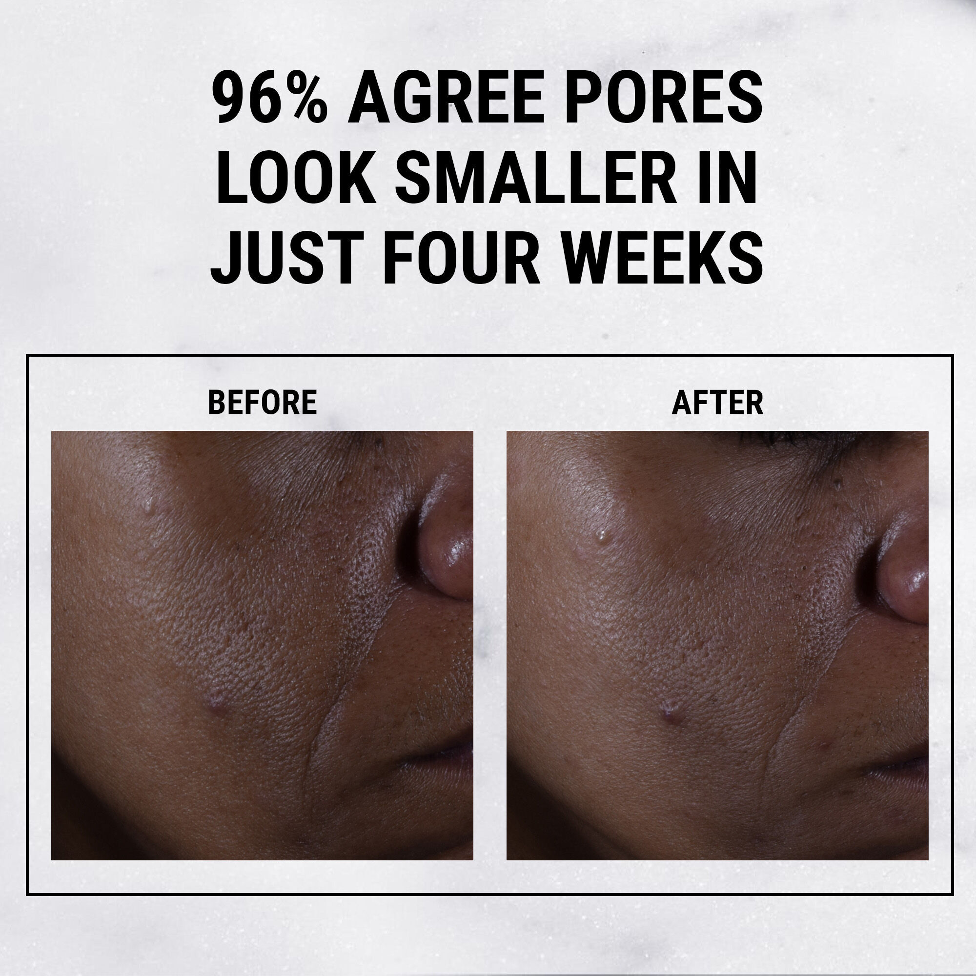Dưỡng Chất Dưỡng Da Ultra Pure Serum 9.8% Glycolic Acid