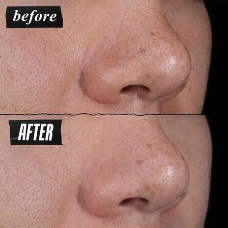 Mặt Nạ Đất Set Kiehl's Rare Earth Deep Pore Cleansing Masque