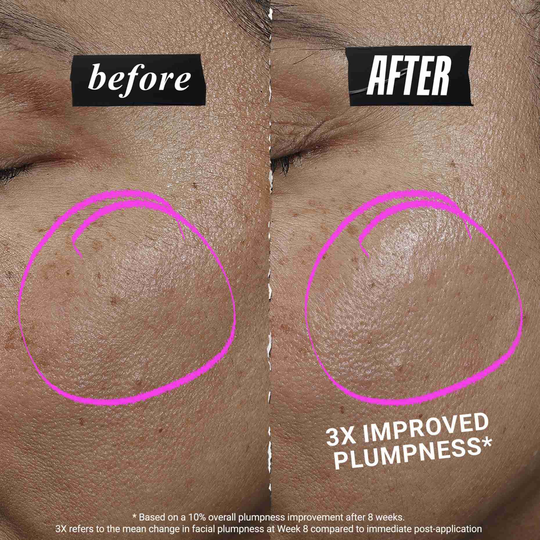 Serum giup da căng mịn & tăng sinh collagen Kiehl’s 1cc CollaShot Plump Serum