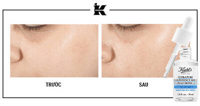 Before and After Retinol Serum