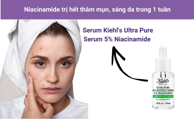Serum Kiehl's Ultra Pure 5% Niacinamide làm sáng da, đều màu và giảm thâm nhanh chóng