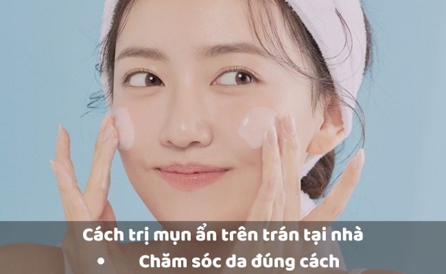 Cách trị mụn ẩn trên trán tại nhà