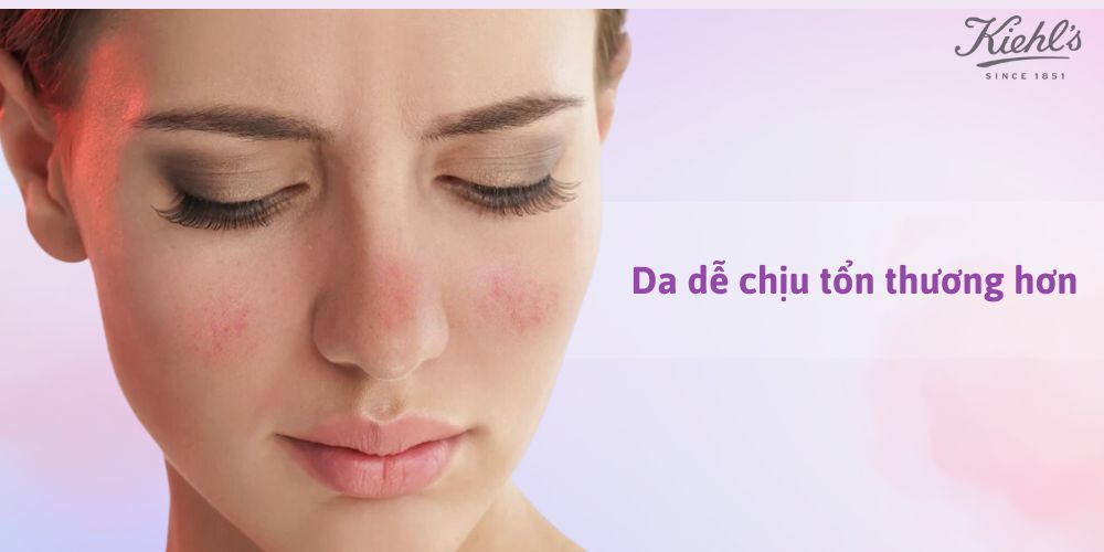 14 dấu hiệu lão hóa da thường gặp
