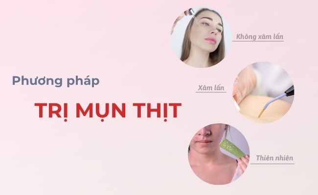 Phương pháp điều trị mụn thịt tận gốc, hiệu quả nhất hiện nay