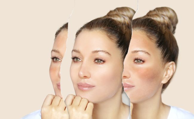 kết hợp bha và niacinamide mang lại hiệu quả gì
