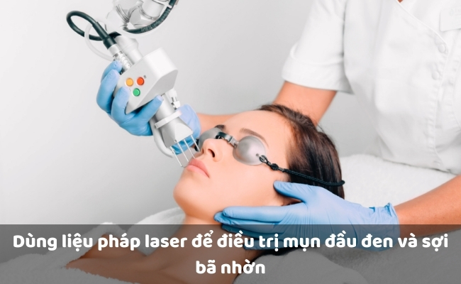 Dùng liệu pháp laser để điều trị mụn đầu đen và sợi bã nhờn