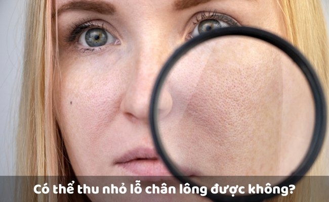 Có thể thu nhỏ lỗ chân lông được không?


