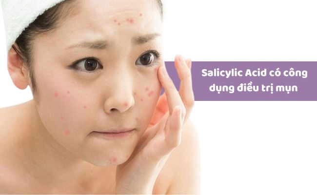 Công dụng của Salicylic Acid là gì?