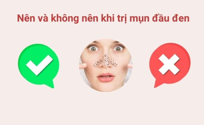 Những điều nên và không nên làm khi điều trị mụn đầu đen