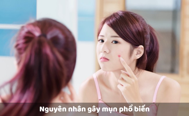 Nguyên nhân gây mụn phổ biến