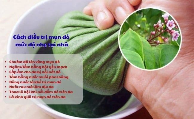 Cách điều trị mụn đỏ trên da ngứa ngáy mức độ nhẹ tại nhà