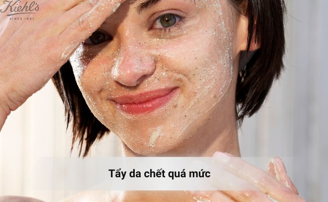 Tẩy da chết quá mức