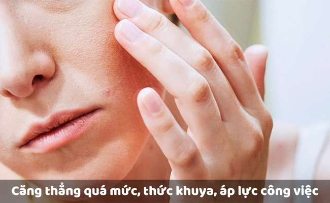 Căng thẳng quá mức, thức khuya, áp lực công việc