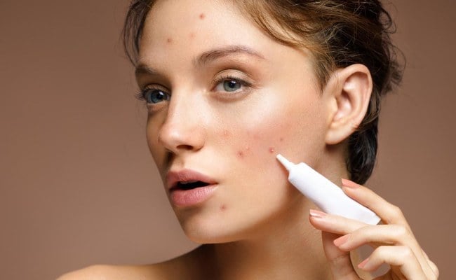 Cách điều trị mụn bọc hiệu quả
