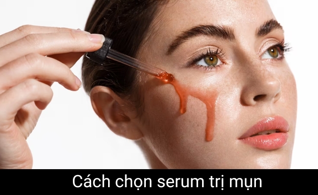 cách chọn serum trị mụn hiệu quả