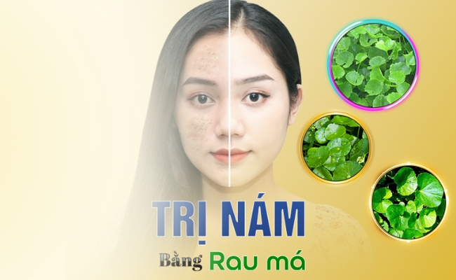 Cách trị nám tại nhà bằng rau má