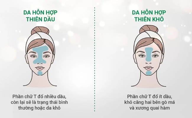 Phân biệt da hỗn hợp Phân loại da hỗn hợp