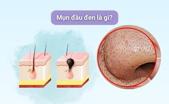 Chọn kem dưỡng chứa thành phần chống lão hóa hiệu quả
