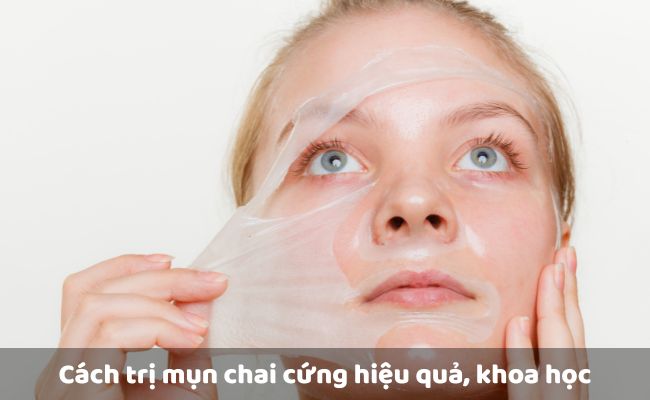 Peel da
 
  