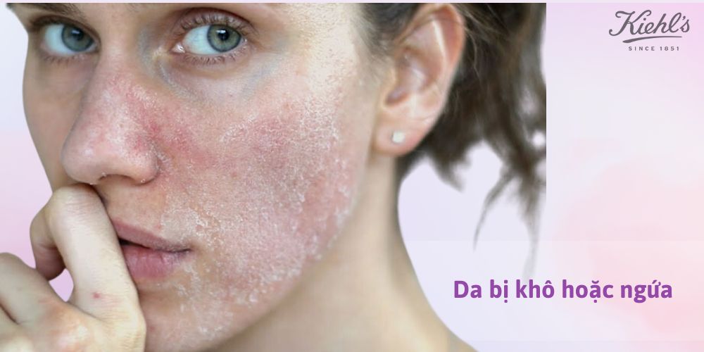 14 dấu hiệu lão hóa da thường gặp