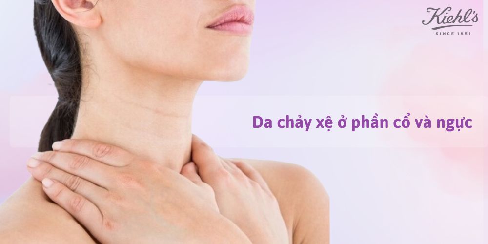 14 dấu hiệu lão hóa da thường gặp