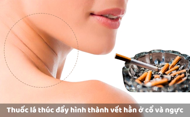 Cách xóa nếp nhăn ở cổ an toàn, đơn giản, hiệu quả nhất