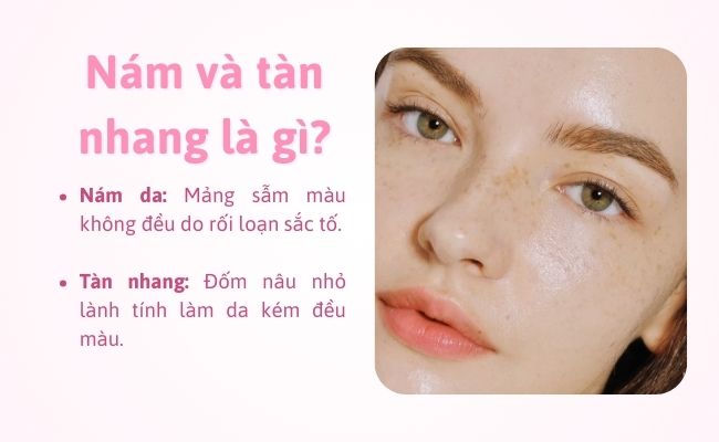 Nám và tàn nhang là gì?