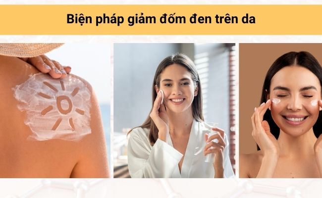 Cách phòng ngừa tình trạng rối loạn sắc tố da