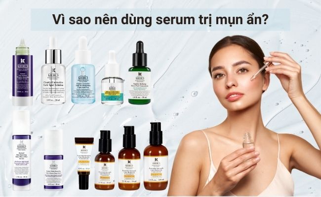 Vì sao nên dùng serum trị mụn ẩn?