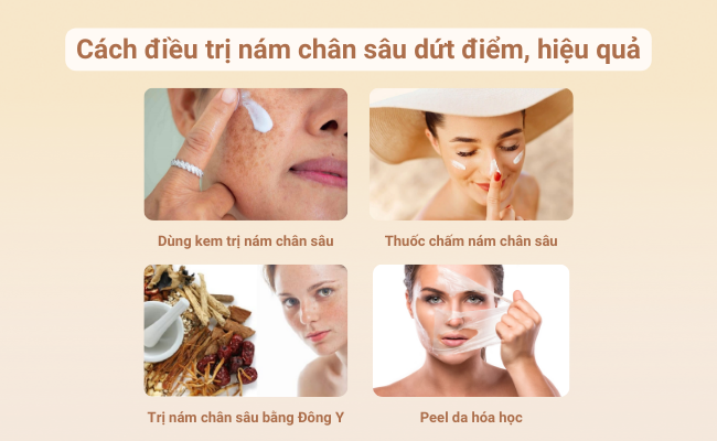 Tổng hợp các phương pháp điều trị nám chân sâu phổ biến như kem bôi, thuốc chấm, peel da và liệu pháp Đông Y giúp cải thiện sắc tố da từ bên ngoài và bên trong.