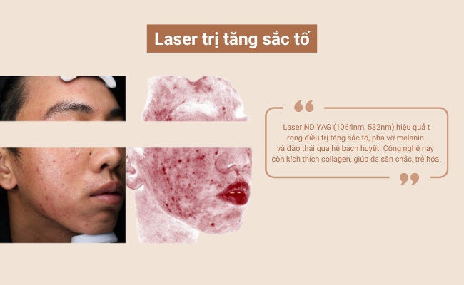 Peel da trị tăng sắc tố cần thực hiện bởi chuyên gia để đảm bảo an toàn