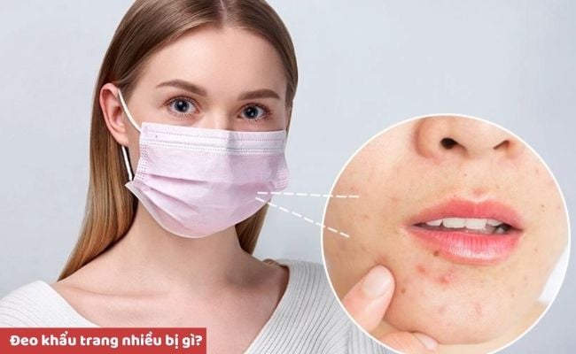 Đeo khẩu trang nhiều bị gì?
