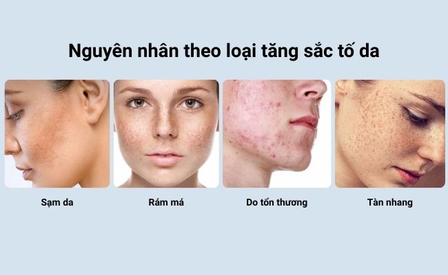 Nguyên nhân theo loại tăng sắc tố da