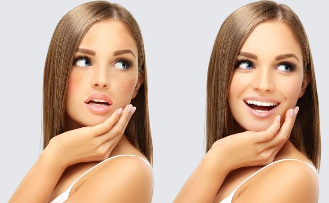 công dụng của vitamin b3 với làn da