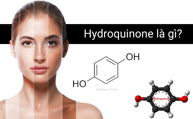 Hydroquinone là gì?