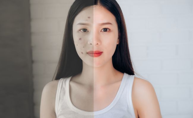 Thời gian Purging kéo dài bao lâu?