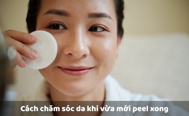 Cách chăm sóc da khi vừa mới peel xong

