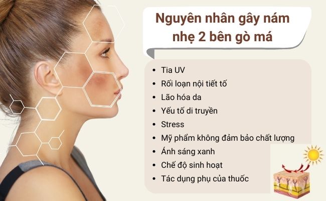 Nguyên nhân gây nám nhẹ 2 bên gò má