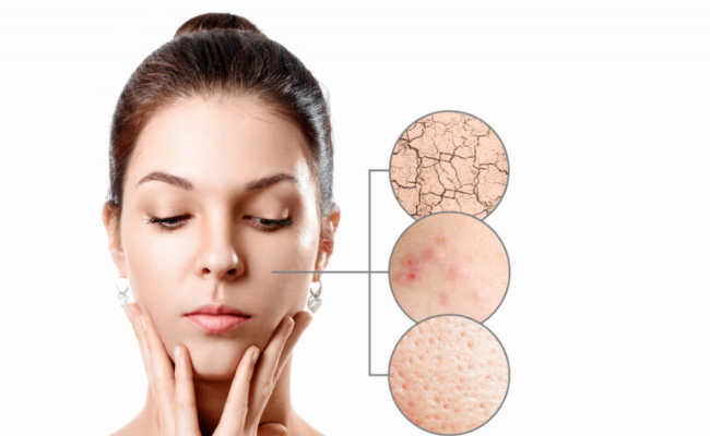 cách nhận biết da hỗn hợp thiên dầu