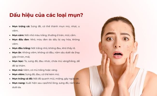Dấu hiệu của các loại mụn?
