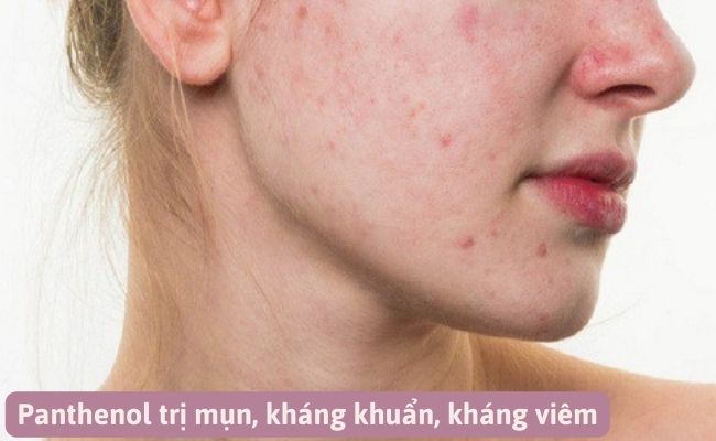 Panthenol có tác dụng gì với da?