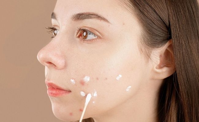 Làm sao để hết mụn tuổi dậy thì nhanh nhất - Sử dụng Retinol