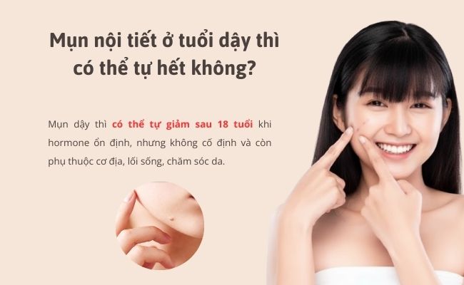 Mụn nội tiết ở tuổi dậy thì có thể tự hết không? Kéo dài bao lâu?