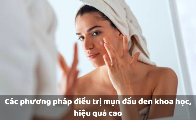 Các phương pháp điều trị mụn đầu đen khoa học, hiệu quả cao