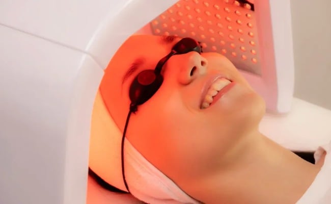 Trị mụn cám bằng liệu pháp quang động